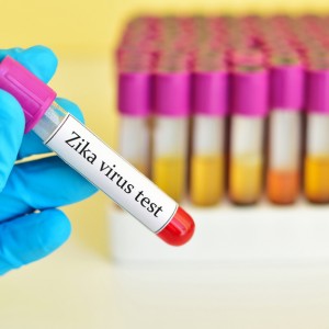 Virus zika y embarazo