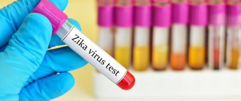 Virus zika y embarazo